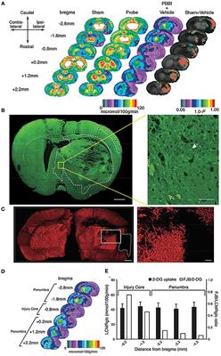 Enduring Neuroprotective Effect of Subacute Neural Stem Cell Transplantation After Penetrating TBI